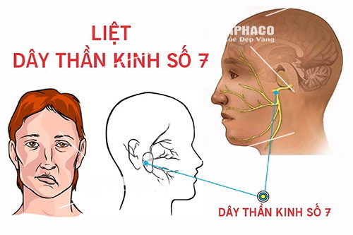 Liệt Dây Thành Kinh Số 7