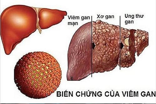 Tăng cường sức khỏe gan từ thảo dược thiên nhiên